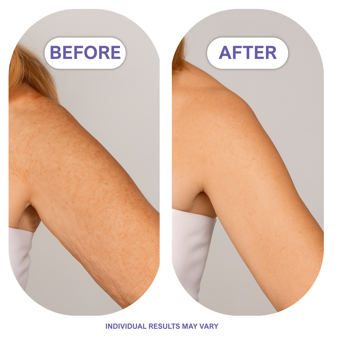 Solisae® Lift & Firm Arm Cream